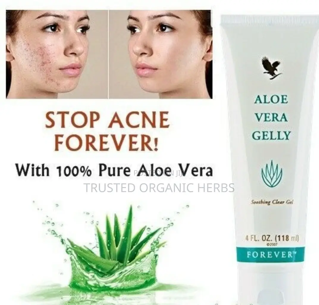Stop Dark Spots Acne and Pimples