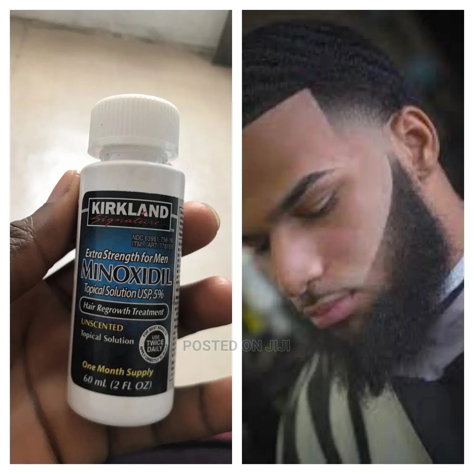 Original Kirkland Minoxidil