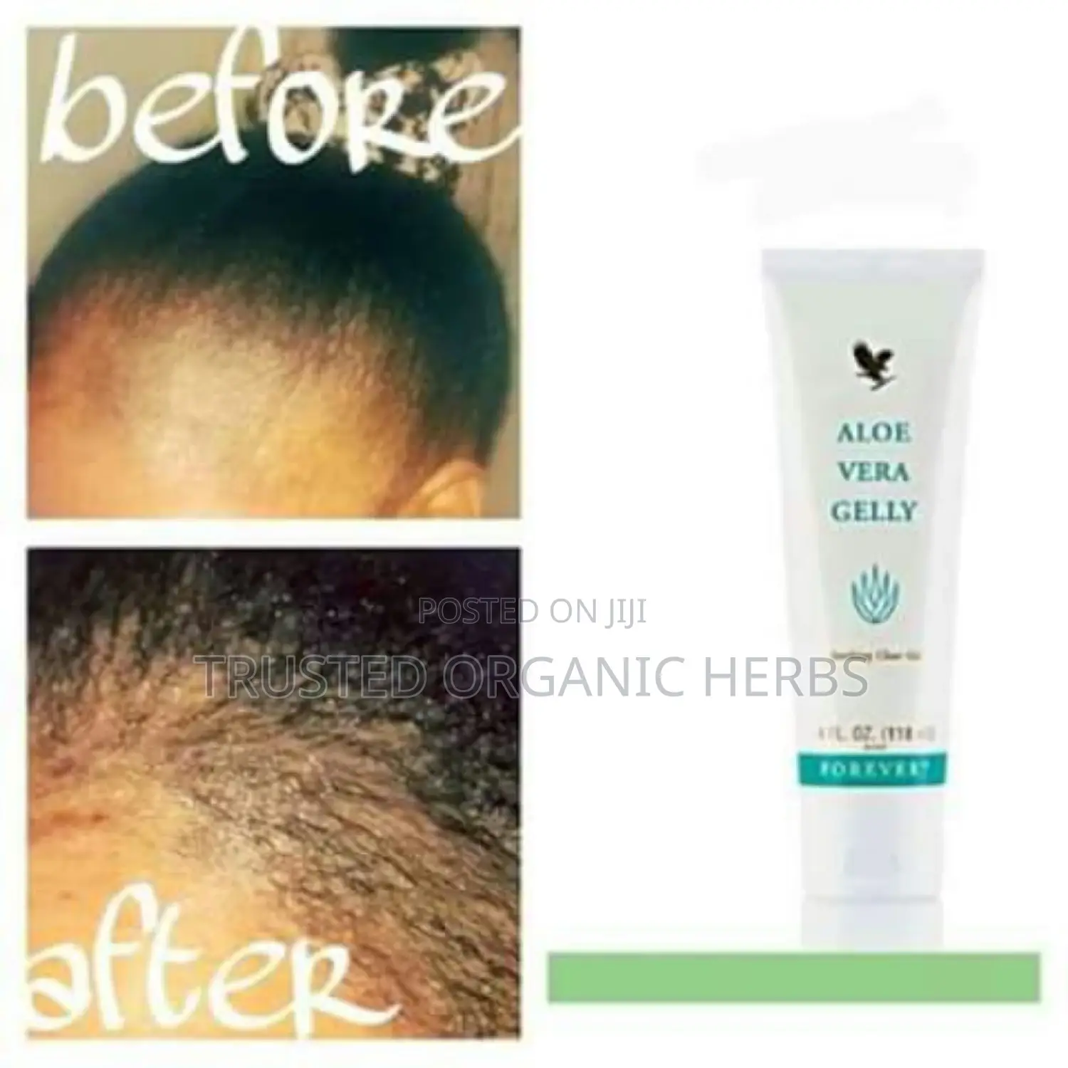 Hair Growth or Hair Loss Treatment