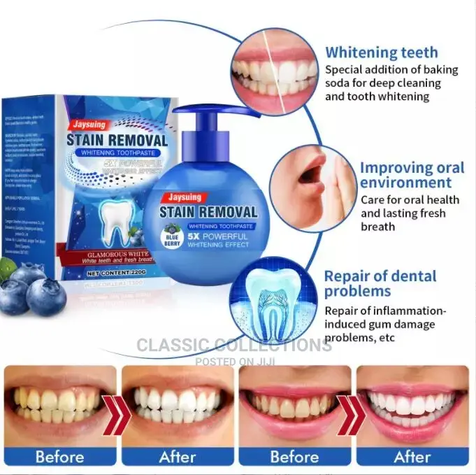 New 5x Whitening Toothpaste by 2 Packs and 1 Pack FREE
