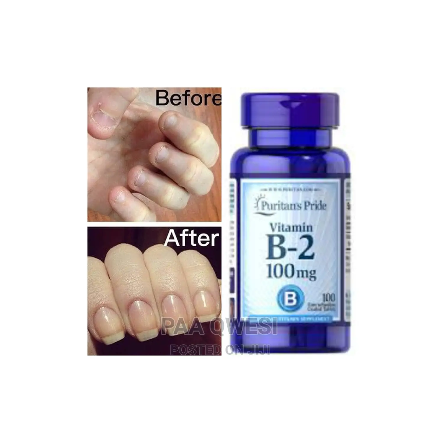 Biotin Puritans