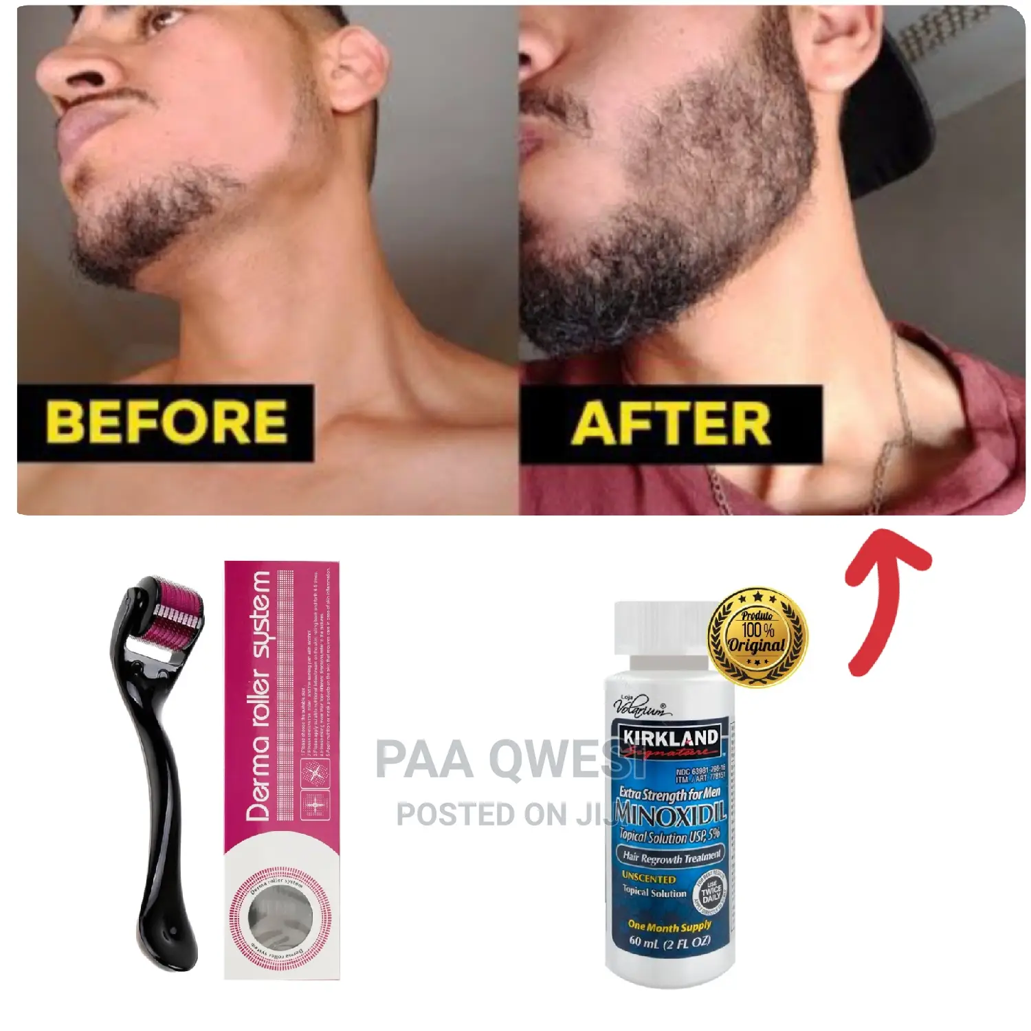 Derma Roller (0.5) /Beard Booster