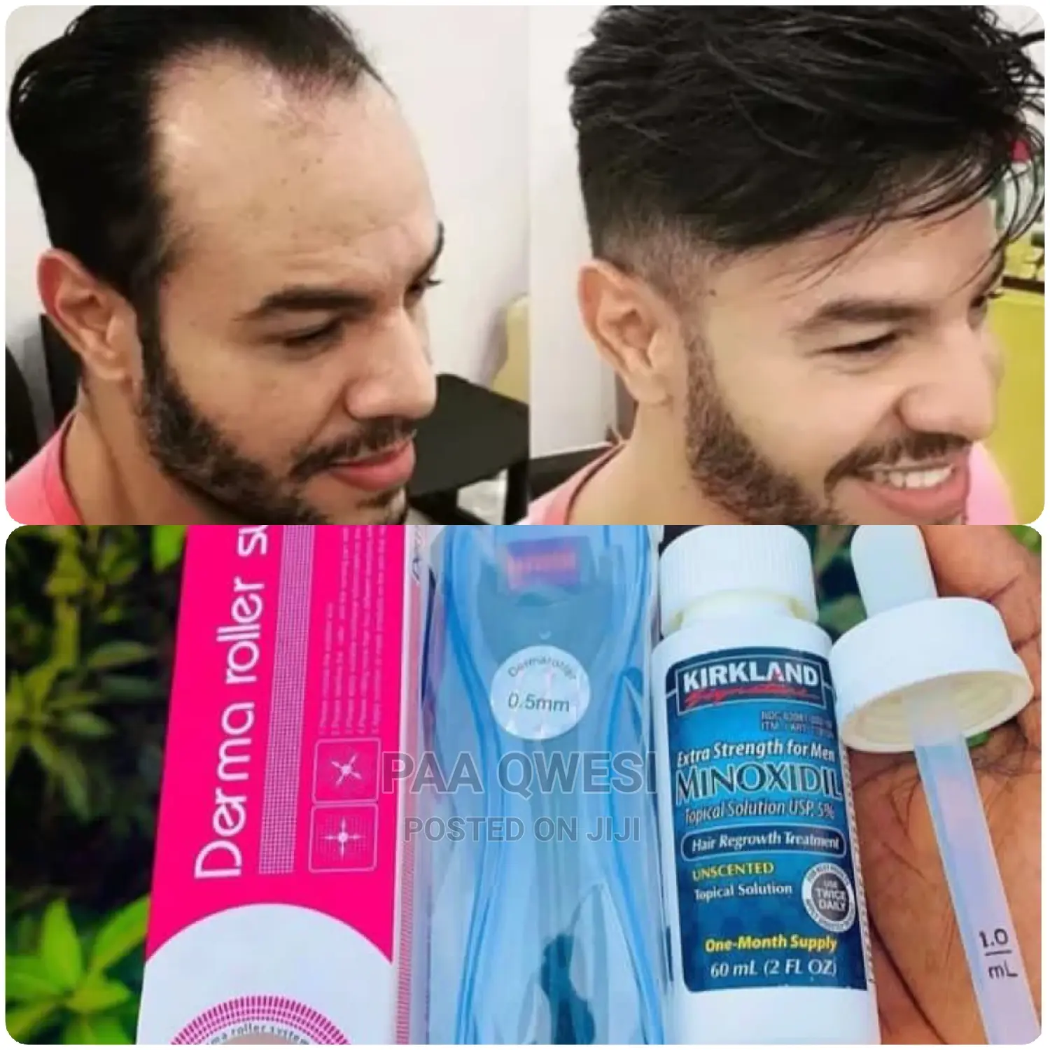 Original Kirkland Oil/Derma Roller (1.0)