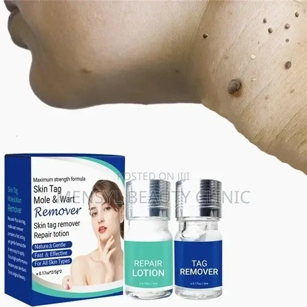 Medical Grade Skin Tag, Genital Wart and Mole Removal 2 in 1