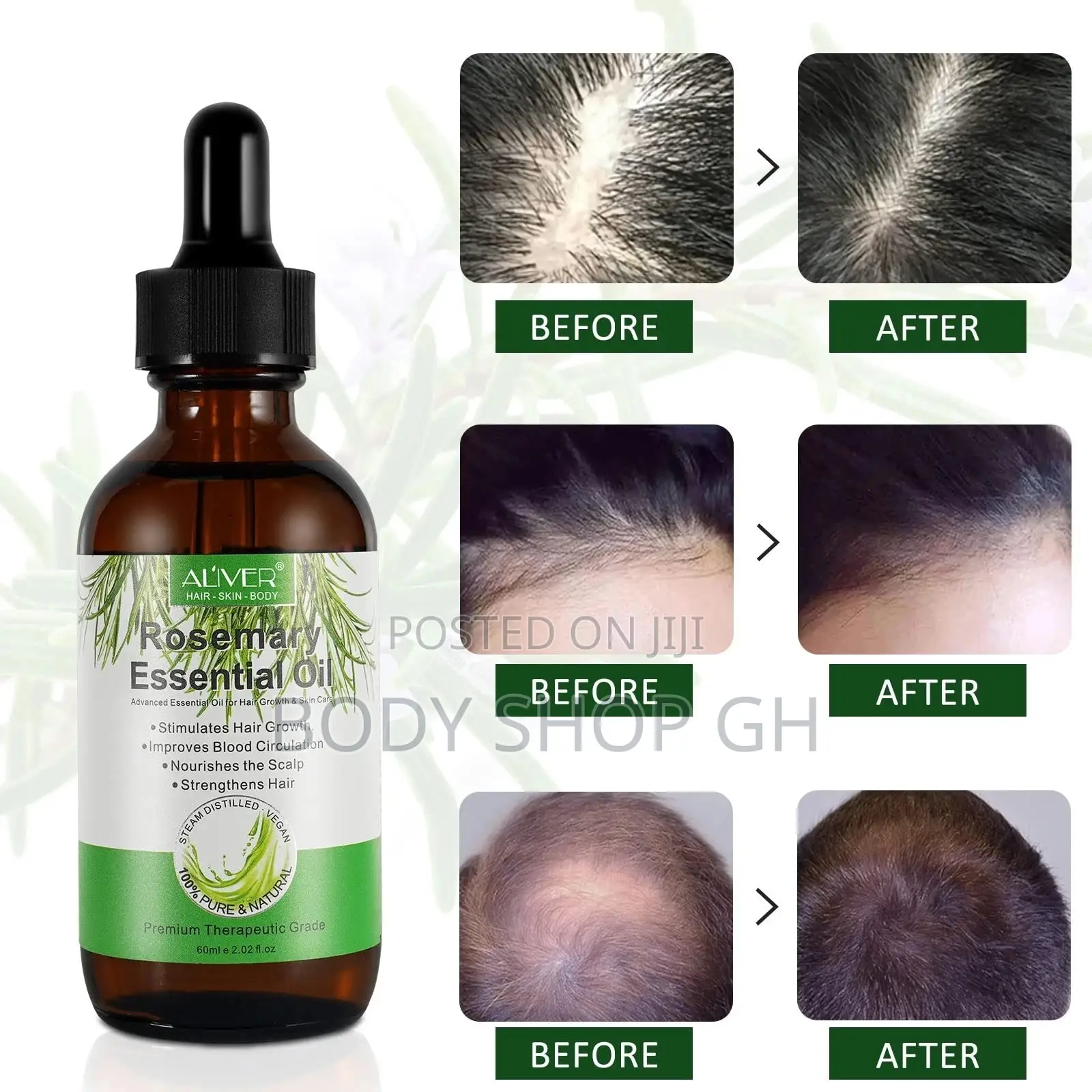 Rosemary Oil for Hair Growth - Stimulates Hair Growth