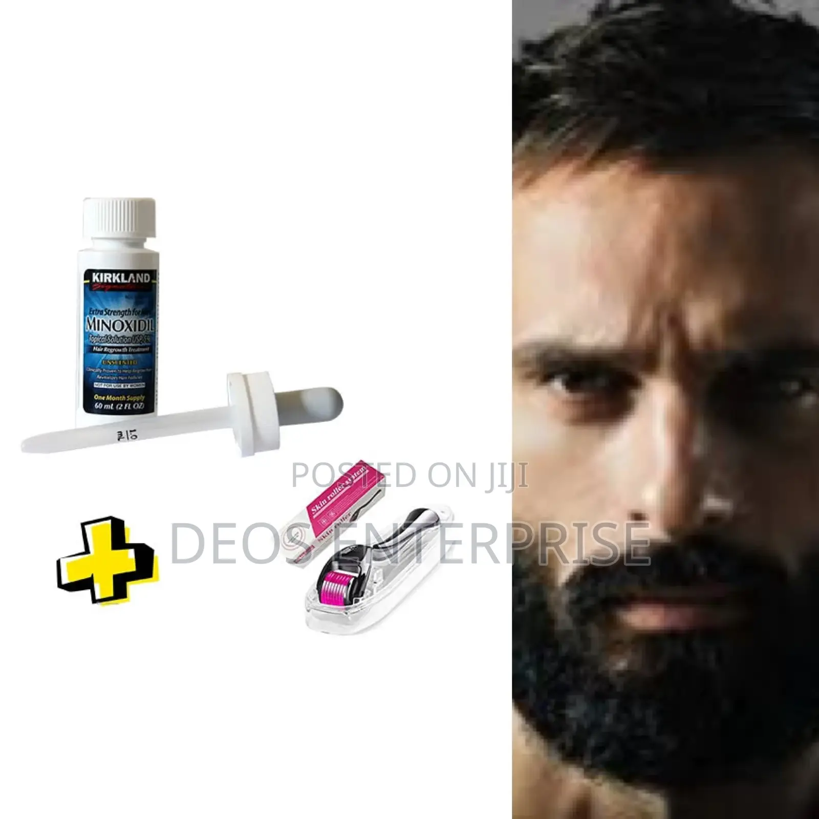 Kirkland Hair Loss Oil and Derma Roller