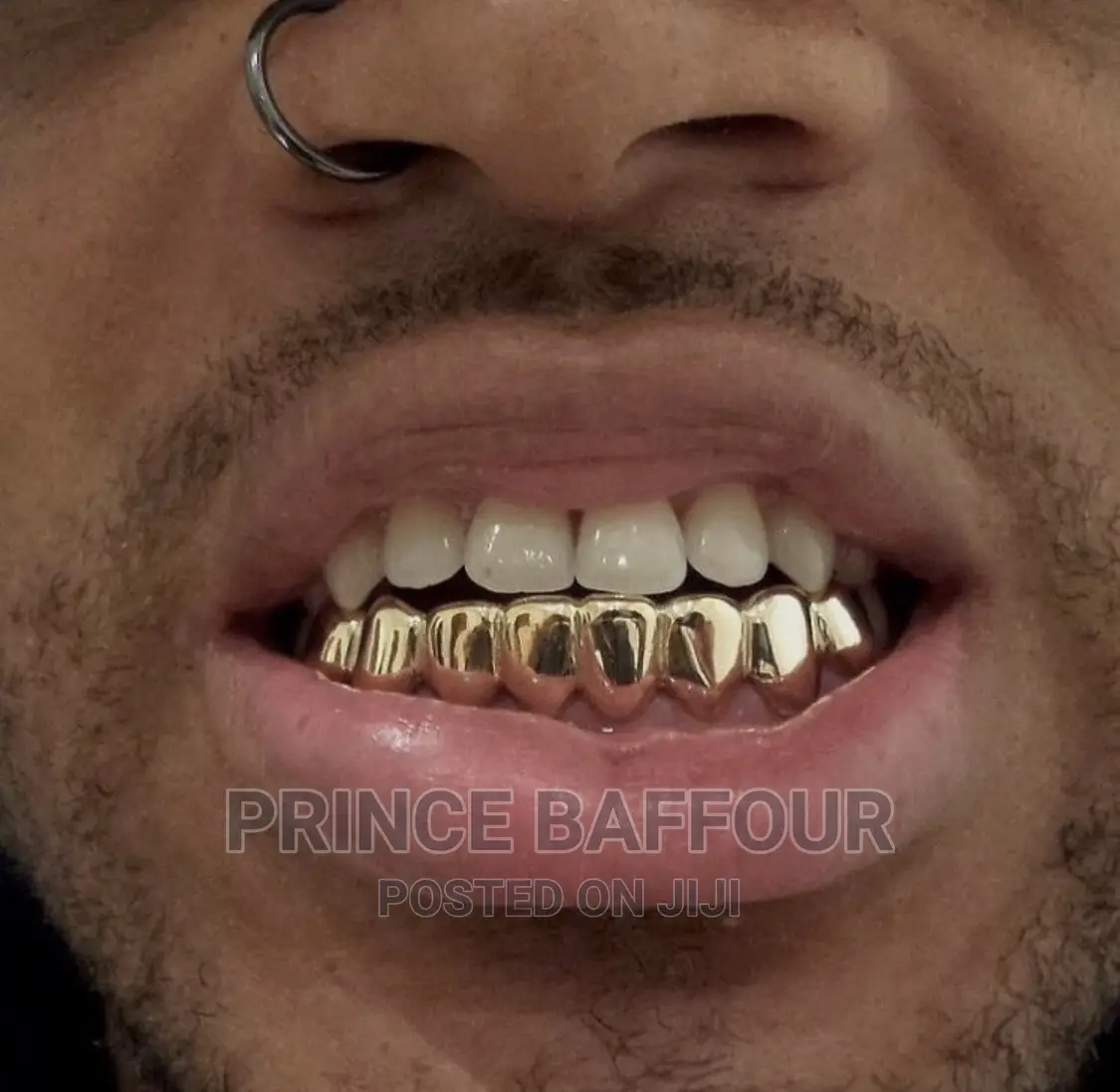 Hip-Hop Teeth /Grillz Teeth /Gold Teeth