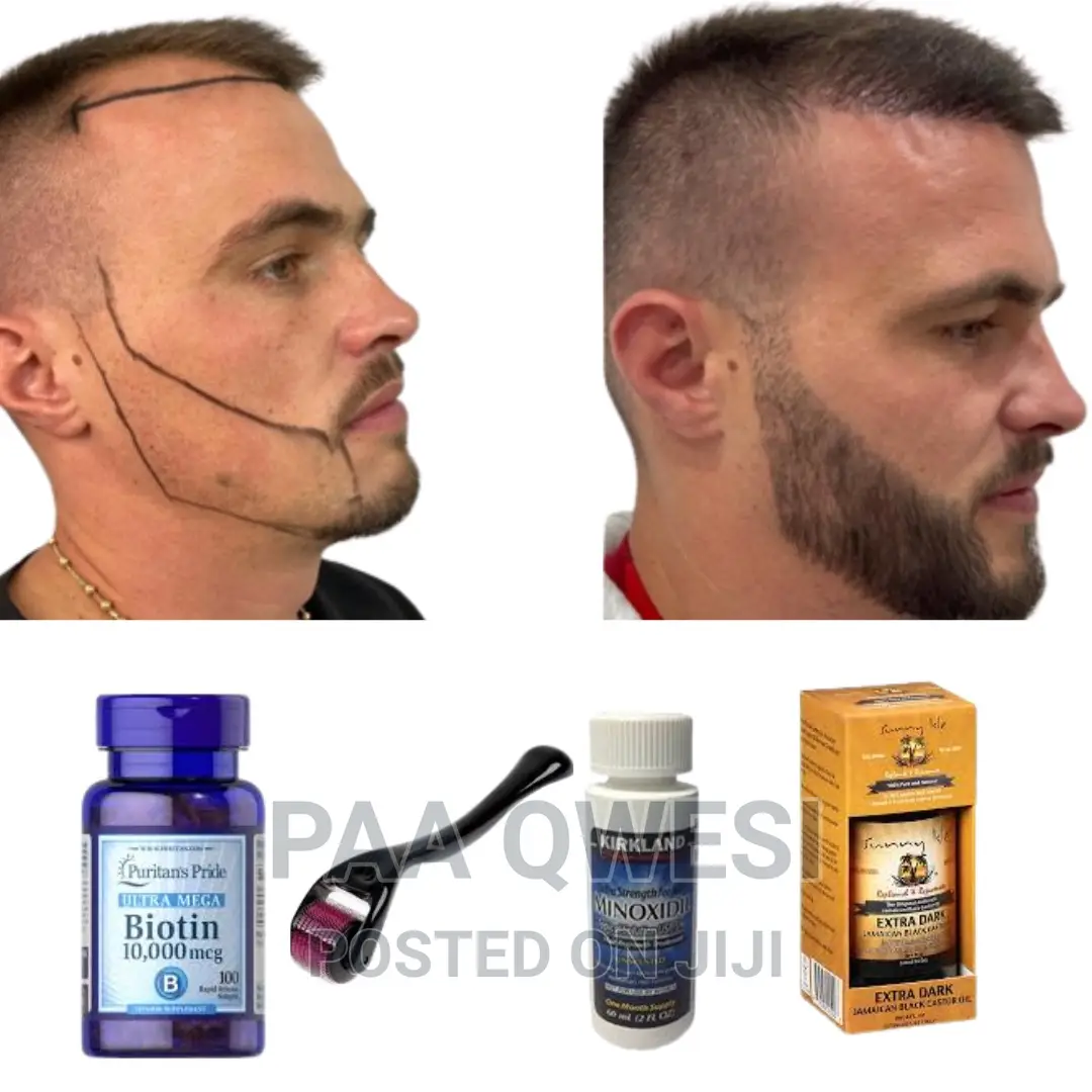 Hairline Loss Full Beard Growth Product {100% Guaranteed}