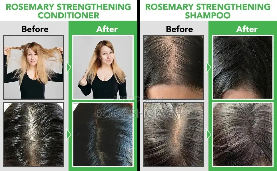Rosemary Conditioner for Hair Growth, Hair Loss and Thinning