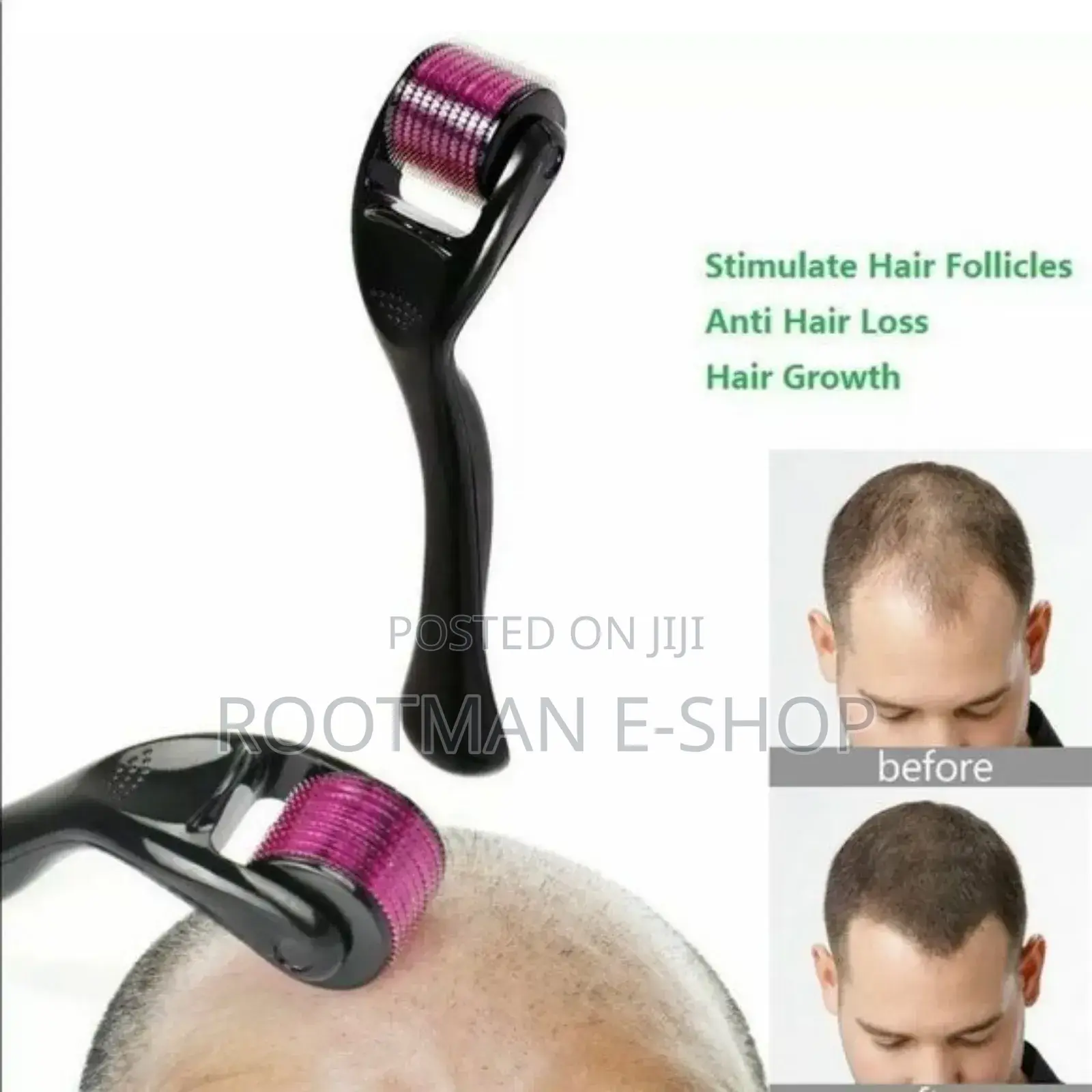 Derma Roller