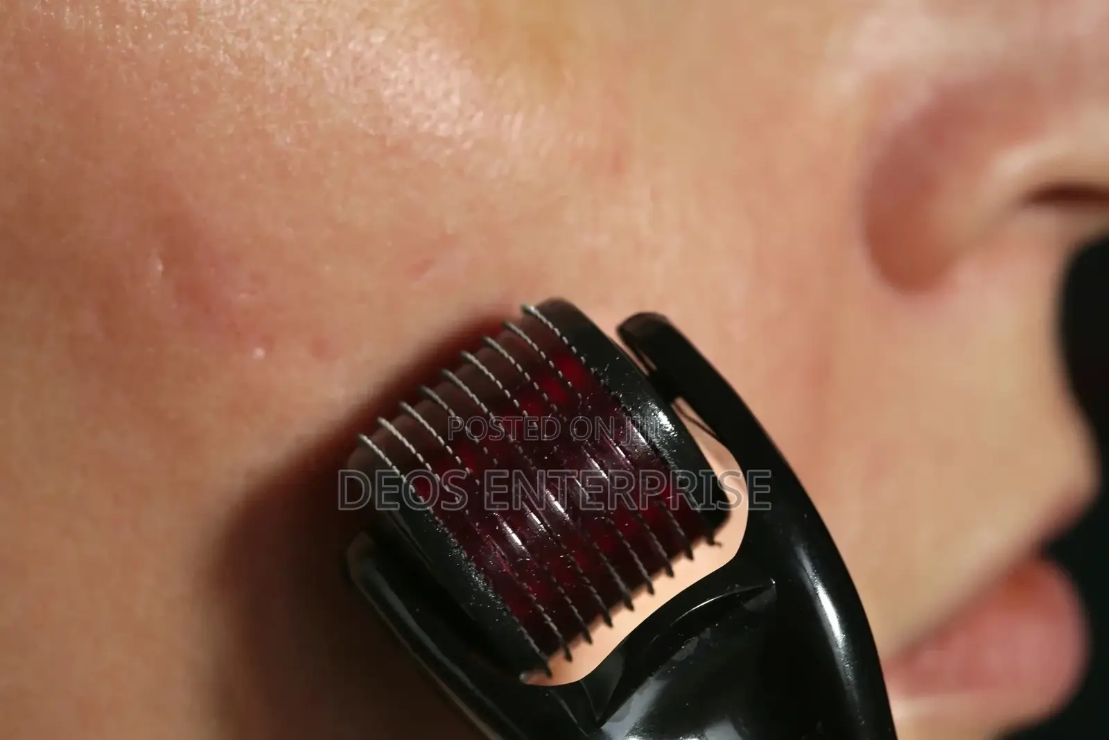 0.5mm Derma Roller for Facial