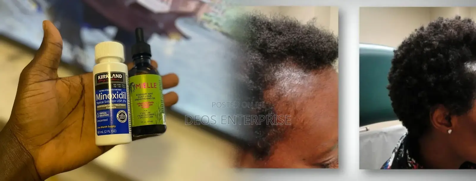 Kirkland Minoxidil Mielle Rosemary Mint for Hair Growth