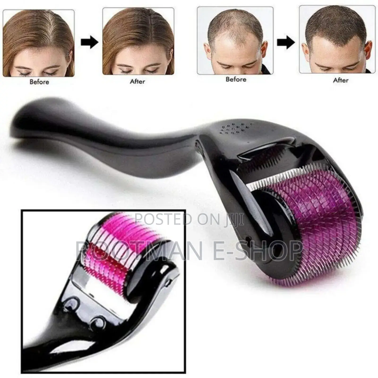 Quality Derma Roller Product