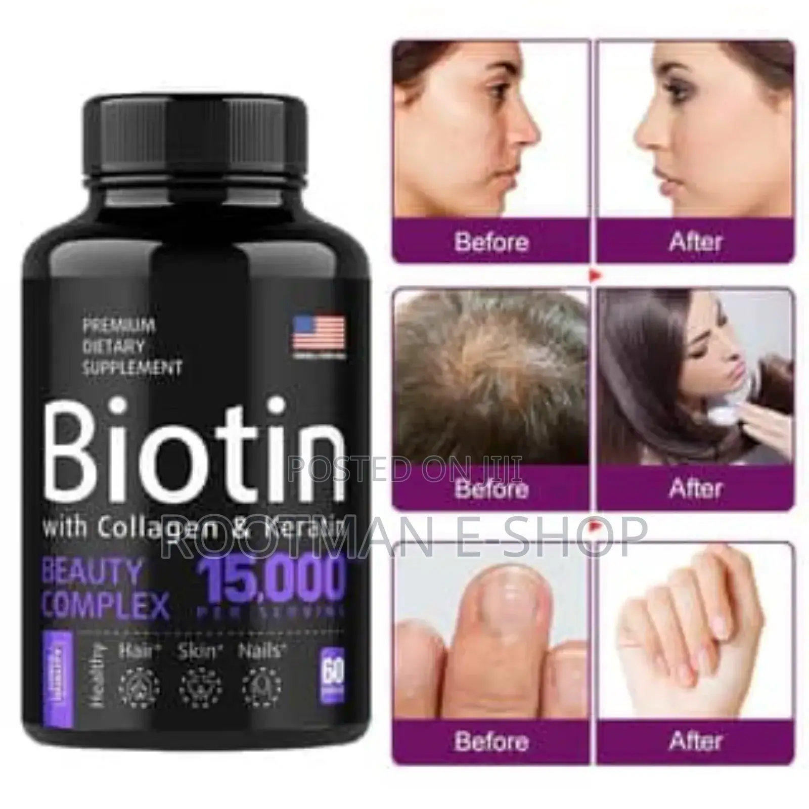 Biotin (Collagen Karetin)
