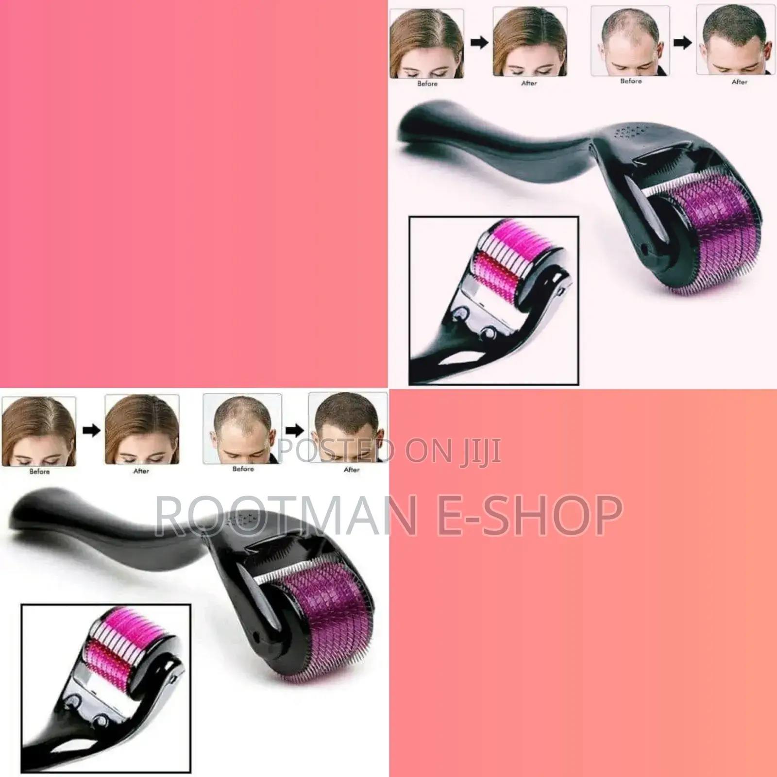 Skin Derma Roller
