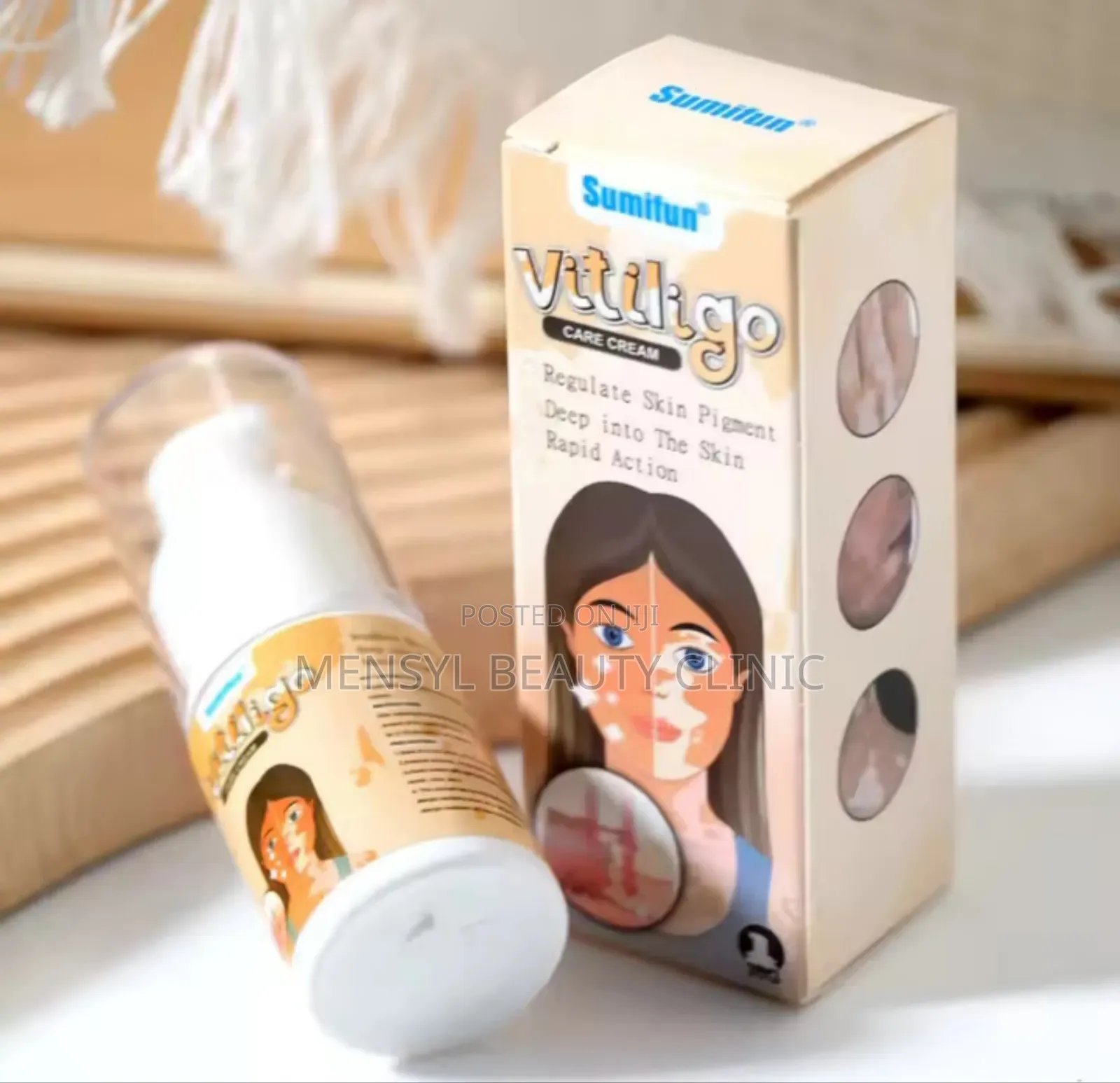 Vitiligo Spray Treatment, and White Spots on Skin