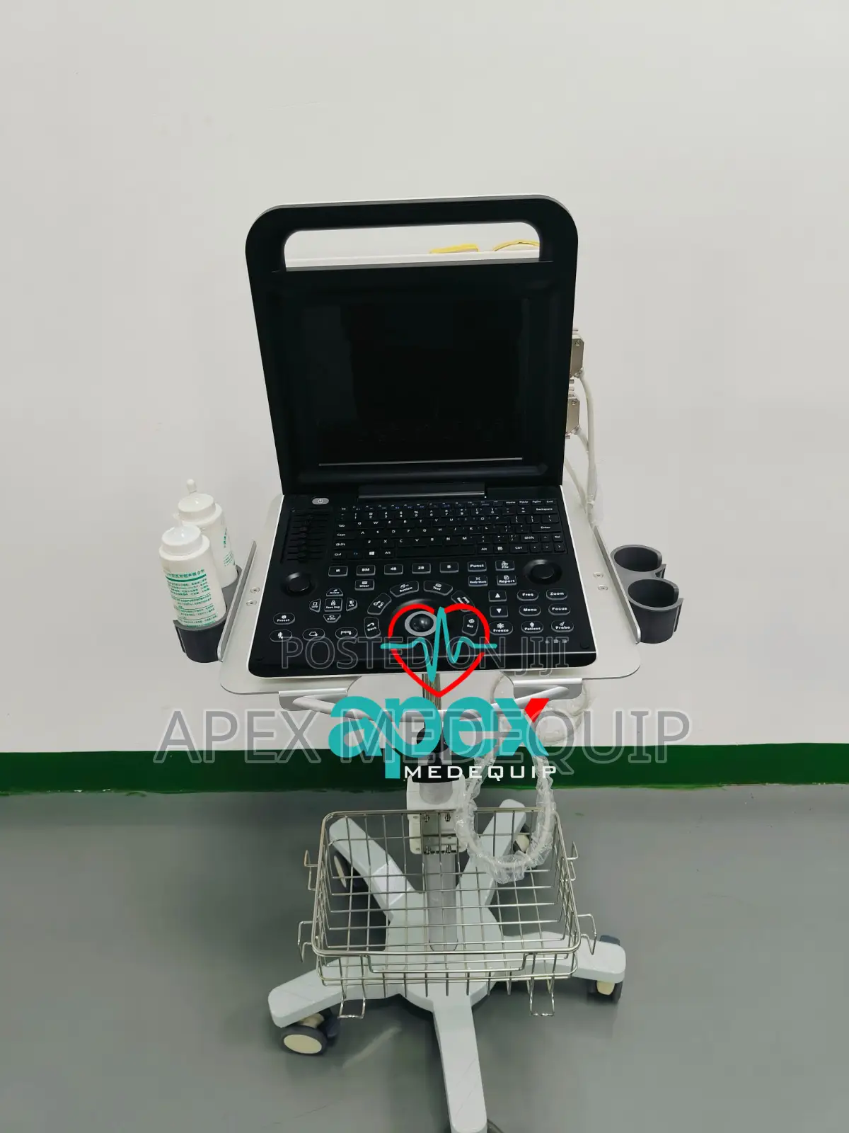 Brandnew Sonotec Dp-30 Digital Ultrasound System + Trolley