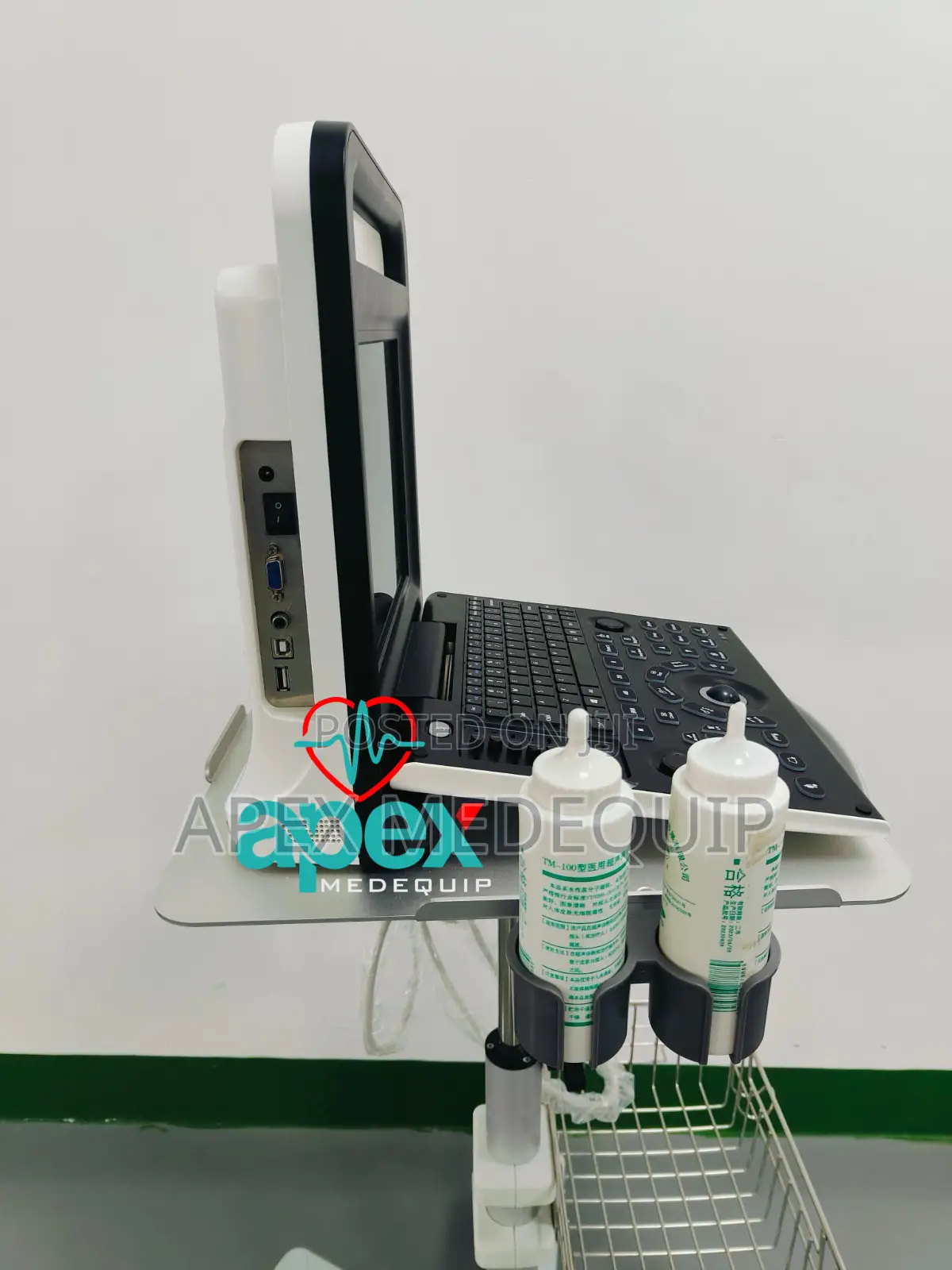 Brandnew Sonotec Dp-30 Digital Ultrasound System + Trolley