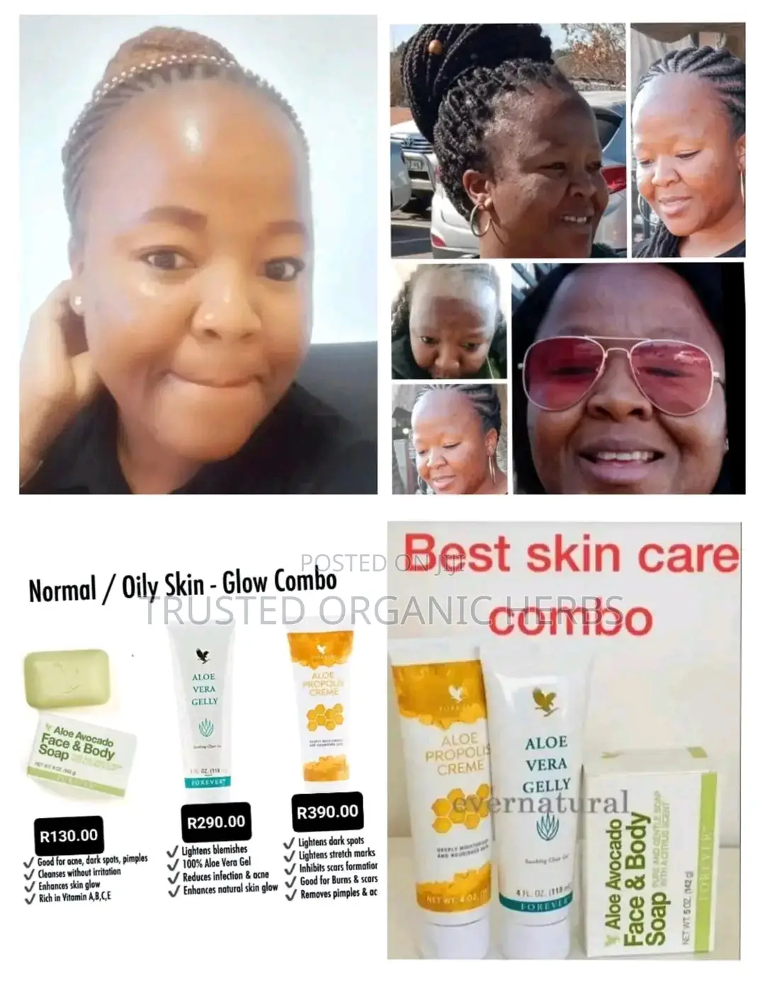 Best Skincare Combo - Acne Solution