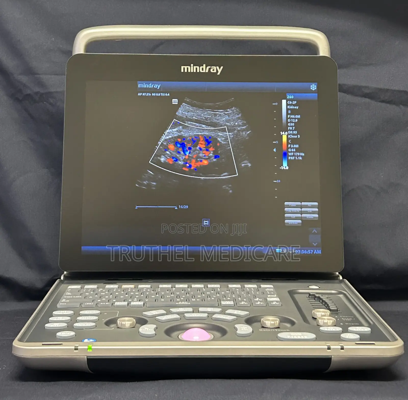 Mindray Portable Ultrasound Machine - Z60 Pro