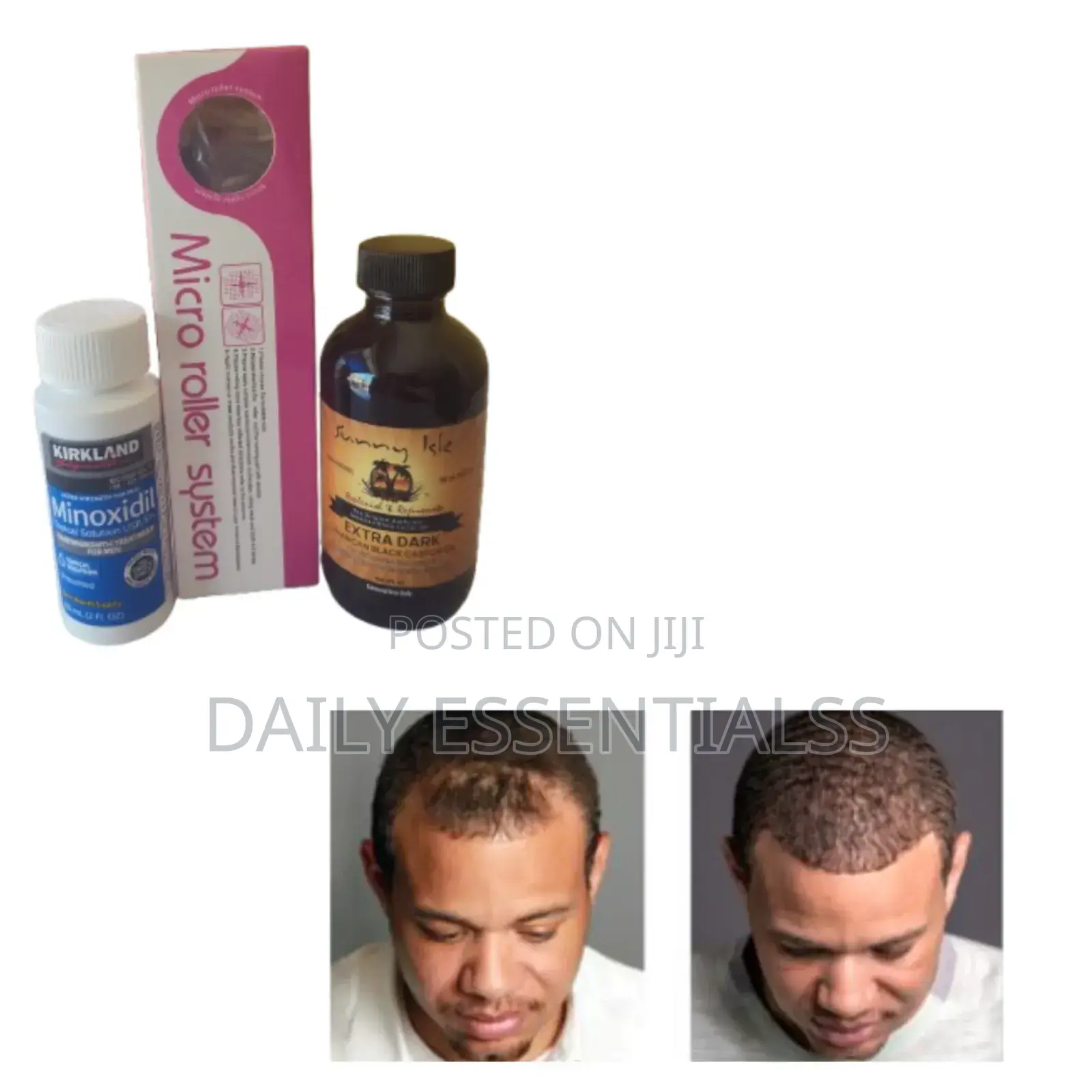 Men Women Hair Growth Kit