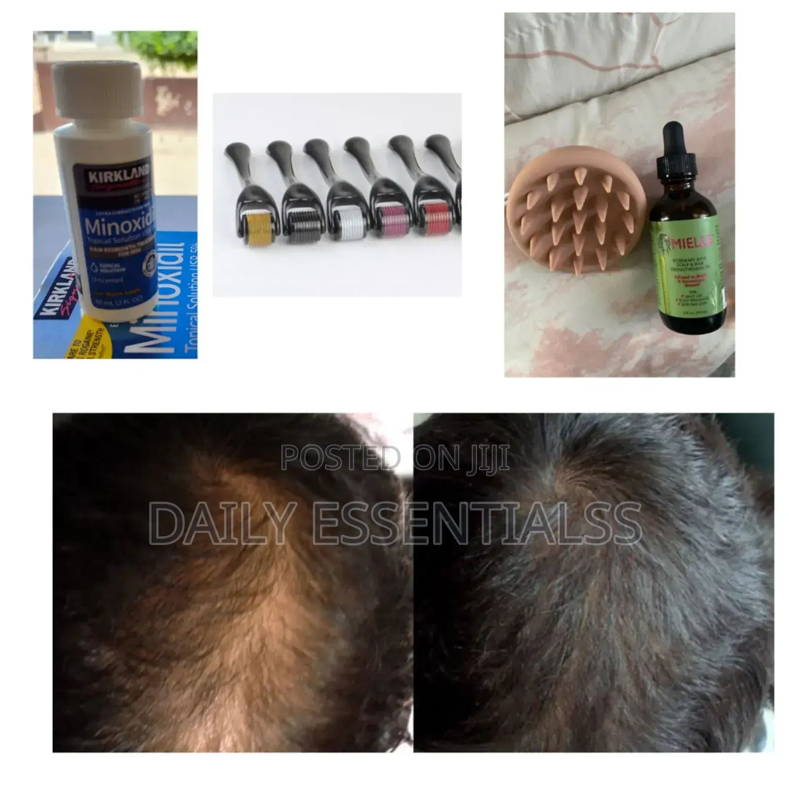 Full Beard Hair Kit: Kirkland, Mielle Derma Roller