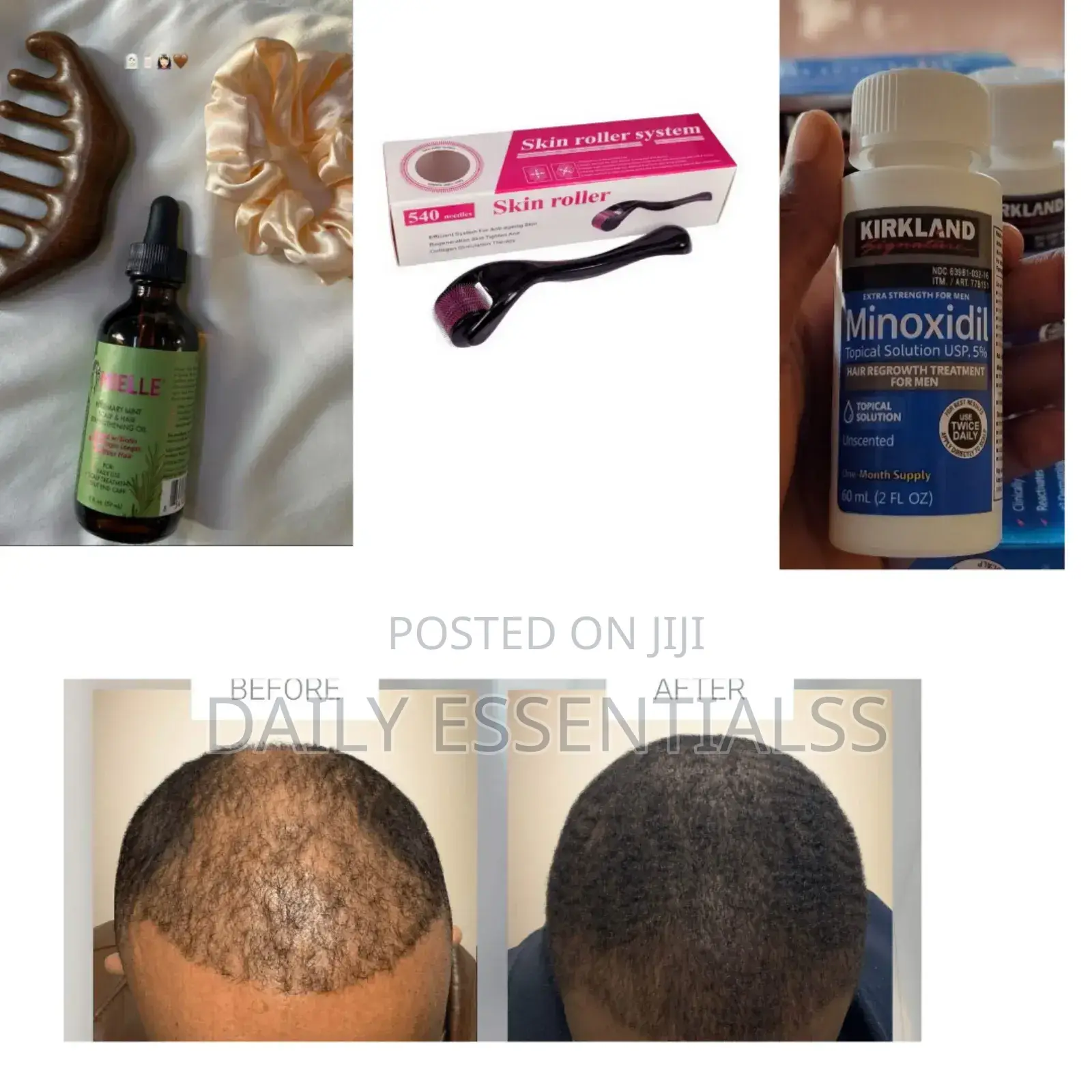 Kirkland Mielle Growth Set With Derma Roller