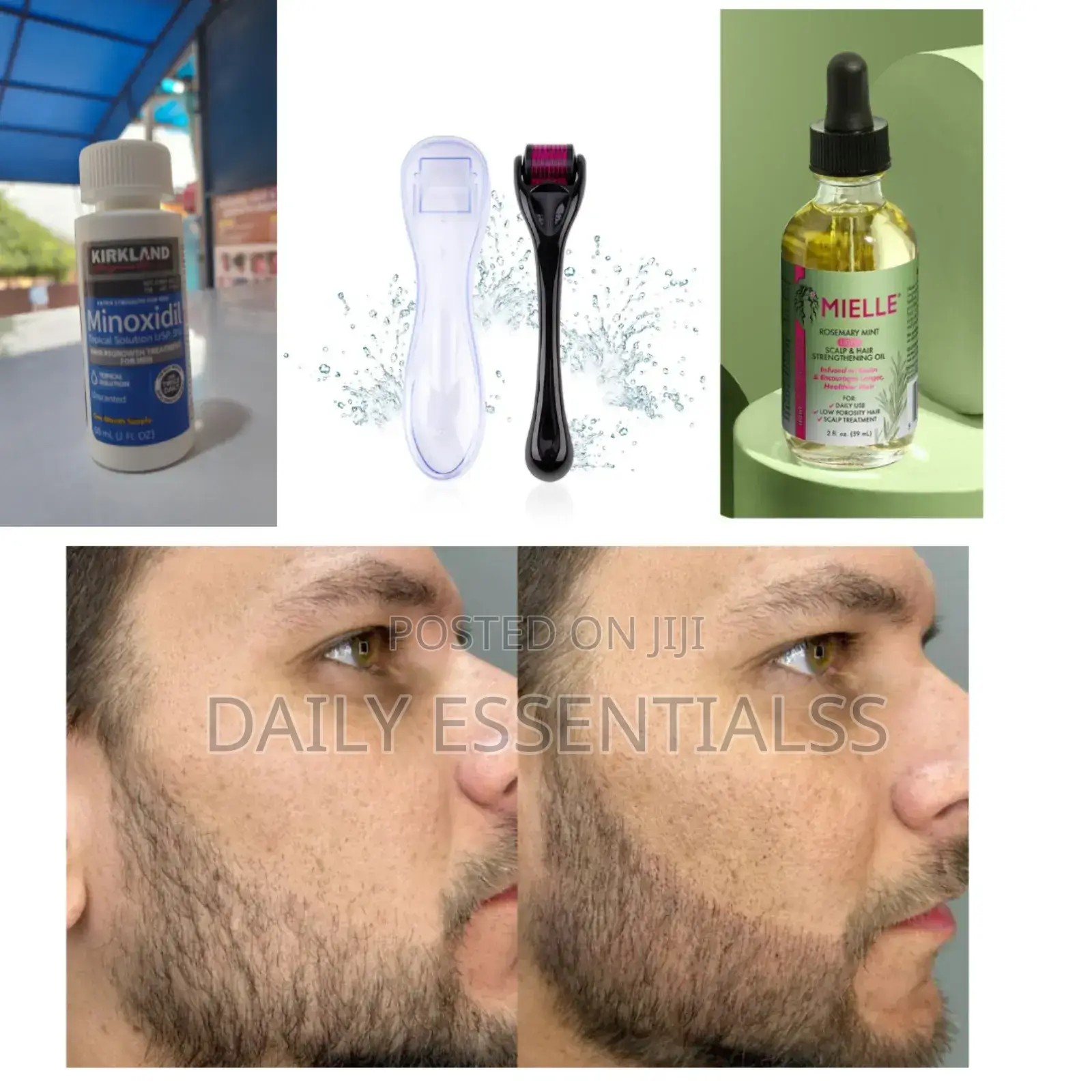 The Power Growth Kit – Kirkland, Mielle Roller Combo
