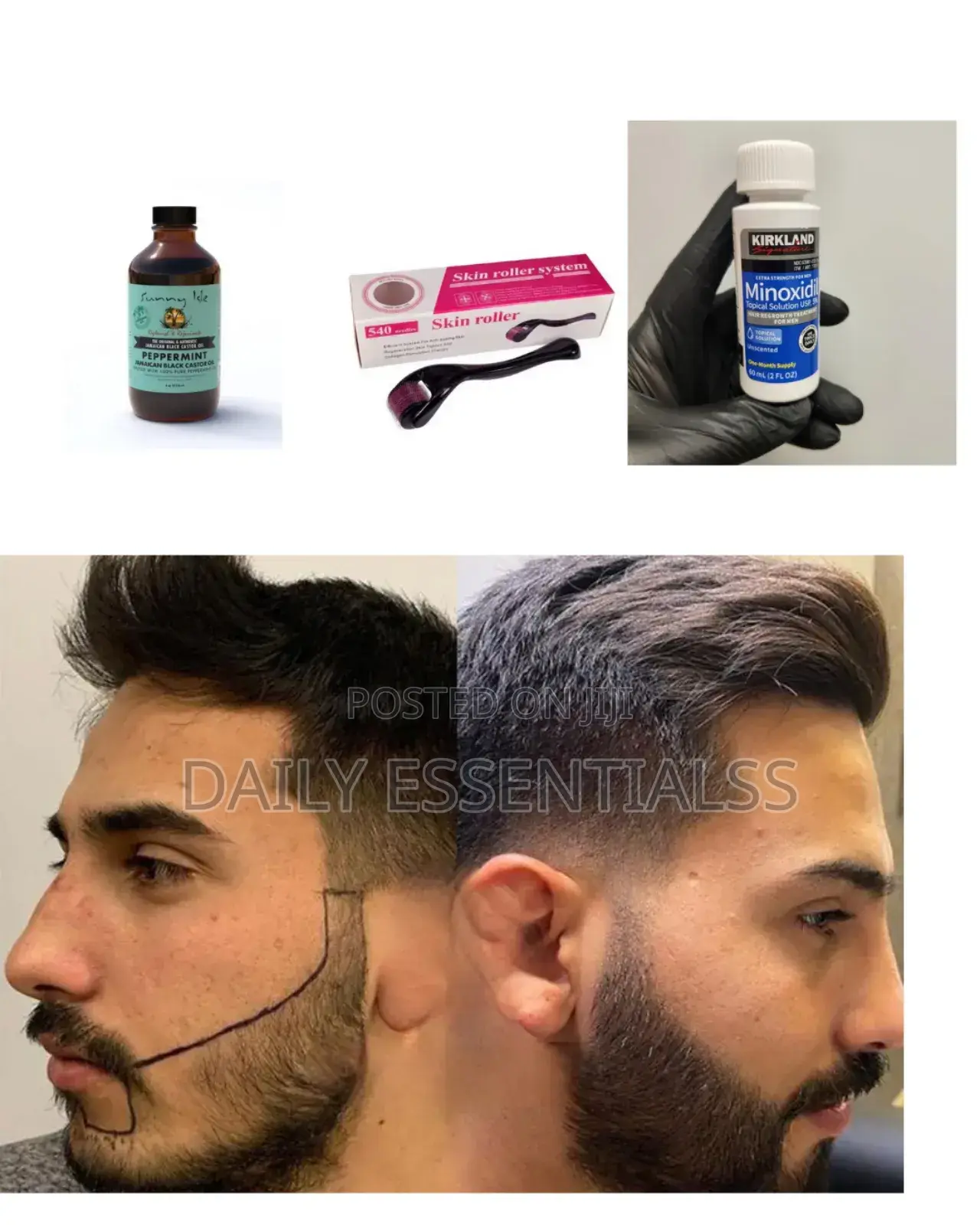 Kirkland Minoxidil, Derma Roller Peppermint Power Pack