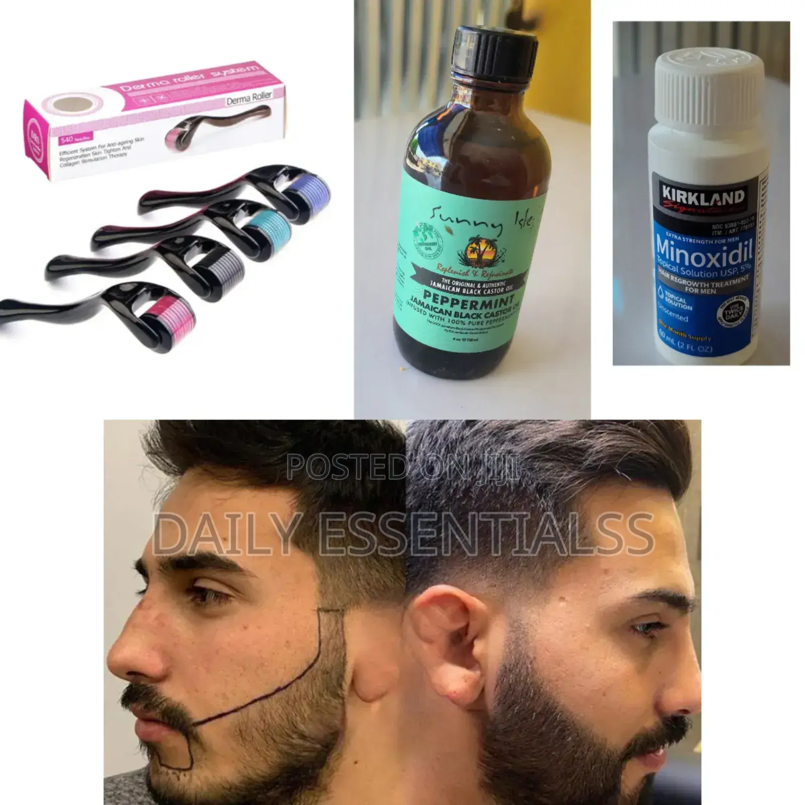 Complete Hair Beard Set:Kirkland,Peppermint Derma Roller