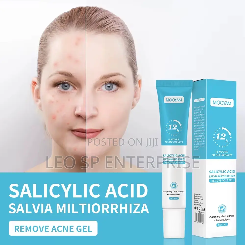 Pimples and Acne Cream