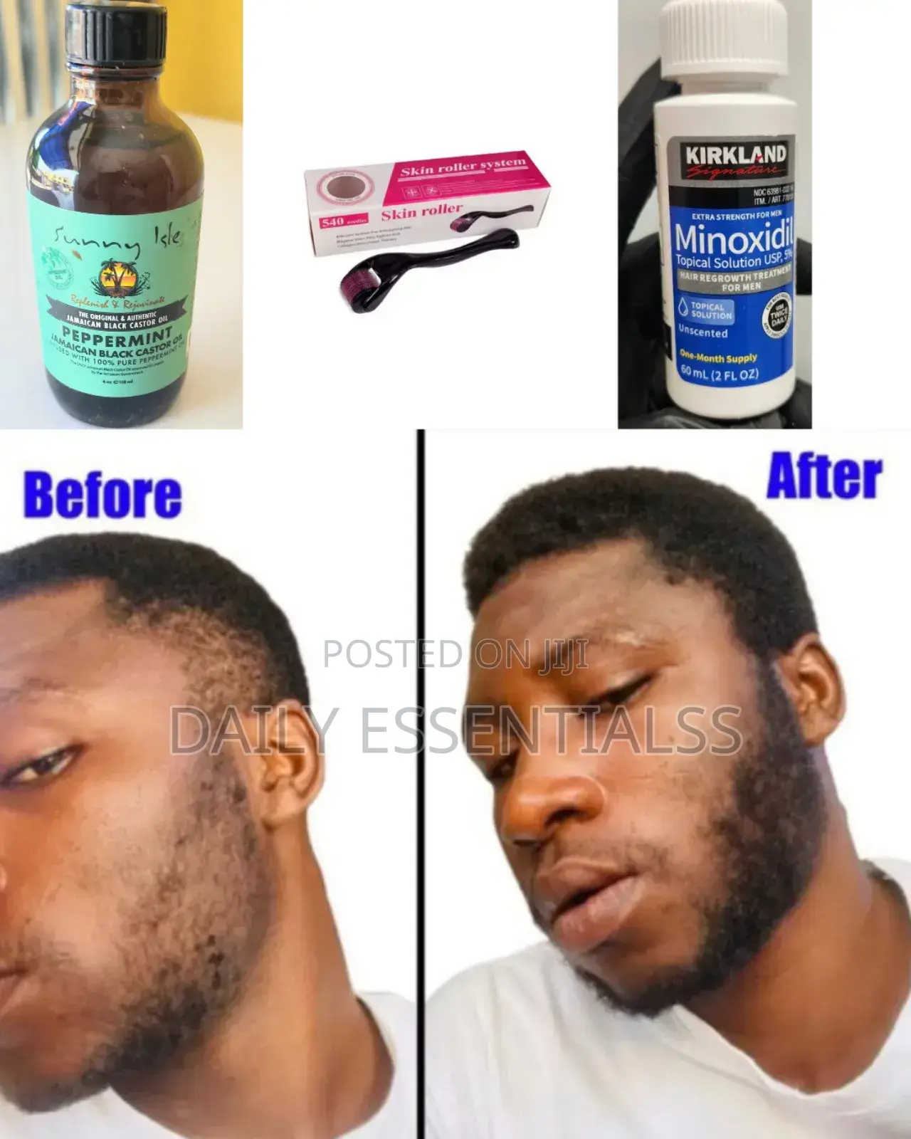Kirkland + Peppermint Oil + Derma Roller Beard Hair Builder