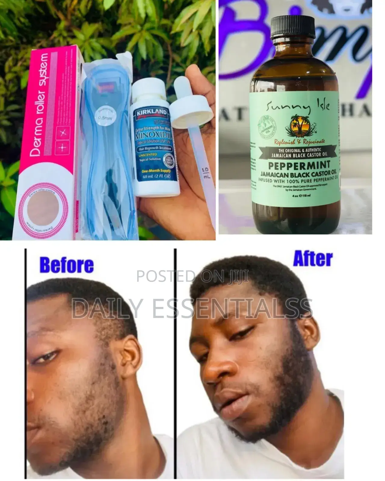 Kirkland, Derma Roller Peppermint – The Growth Team