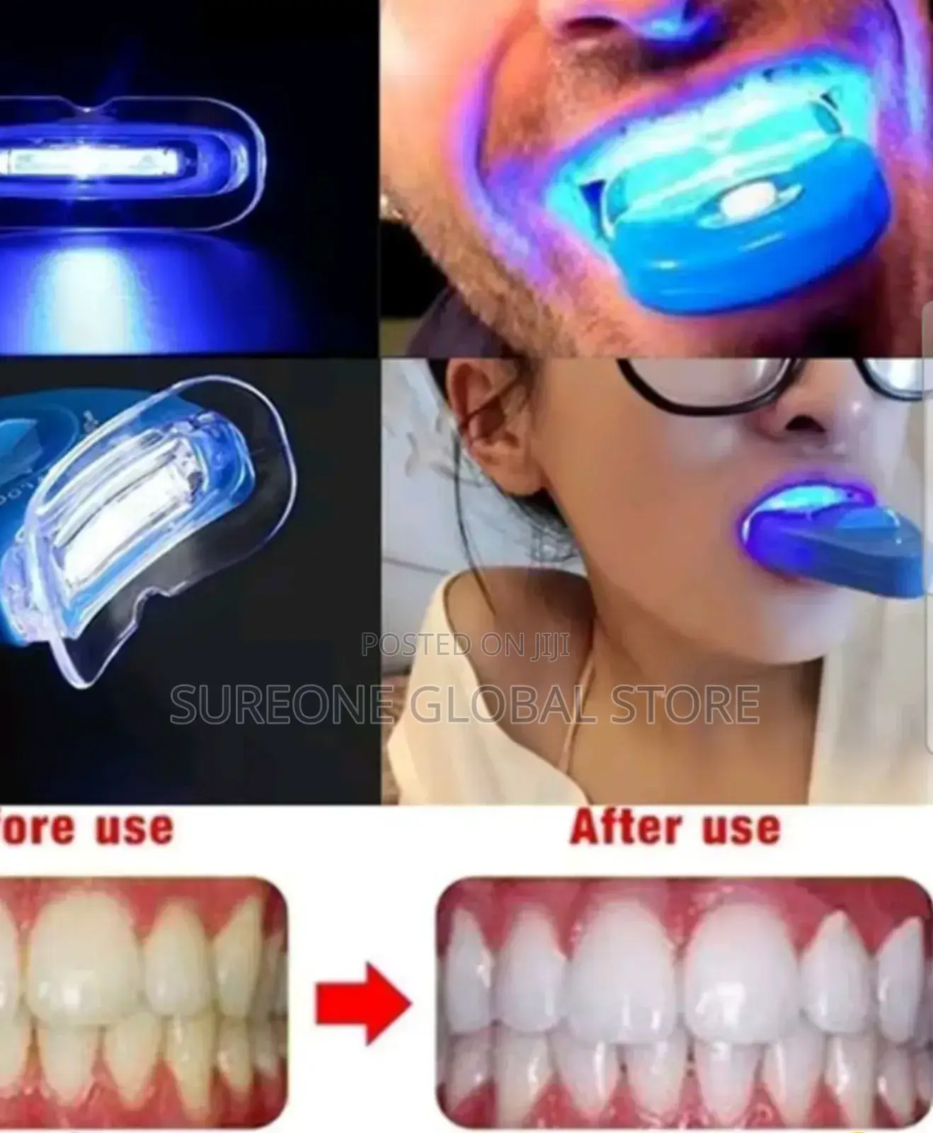 Led Teeth Whitening Light Whitenin