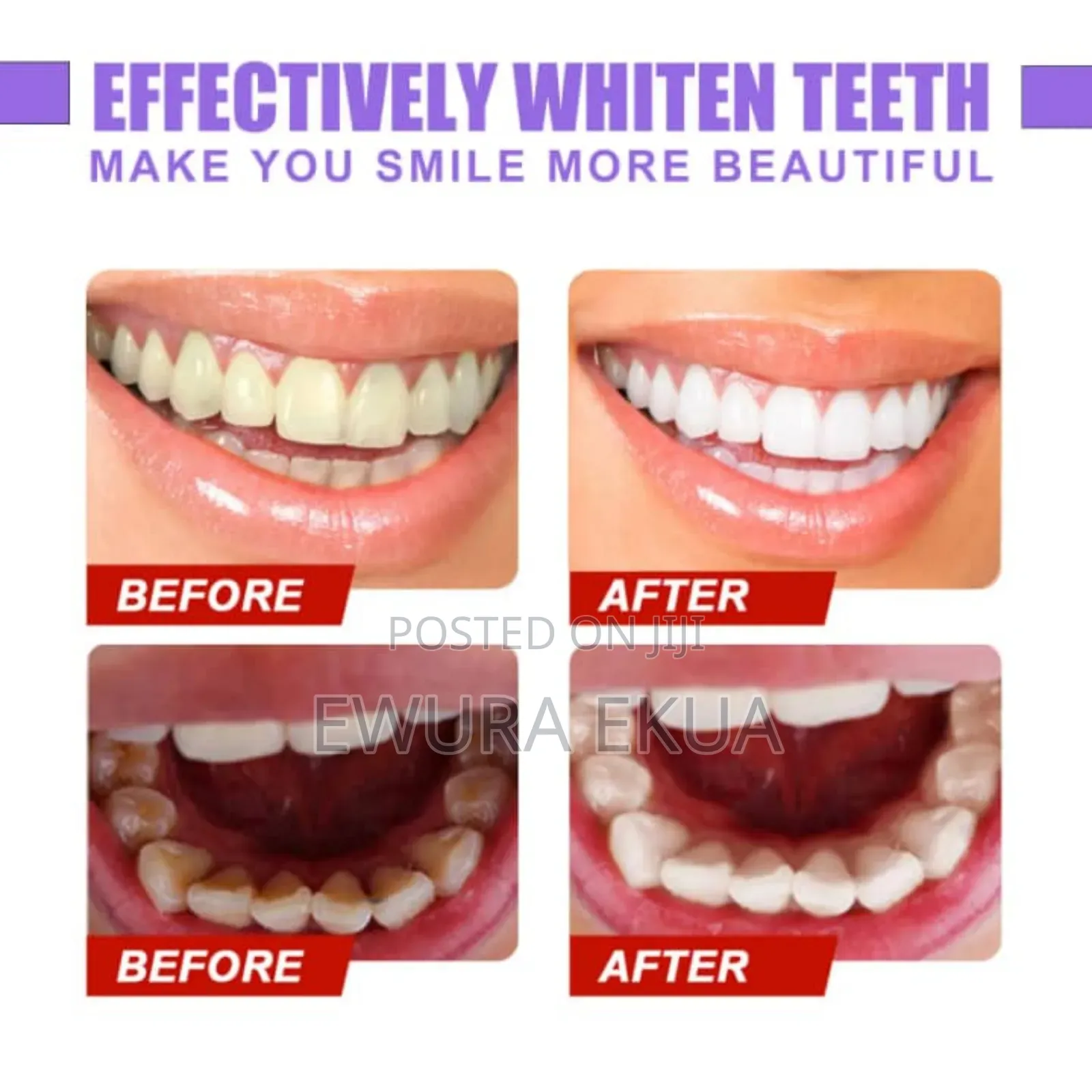 Glorysmile V34 Purple Whitening Toothpaste 30ml