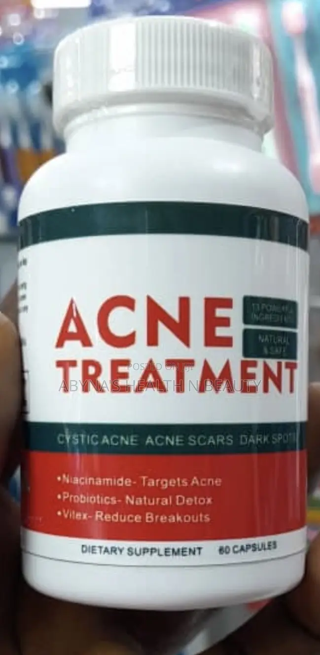 Acne Treatment