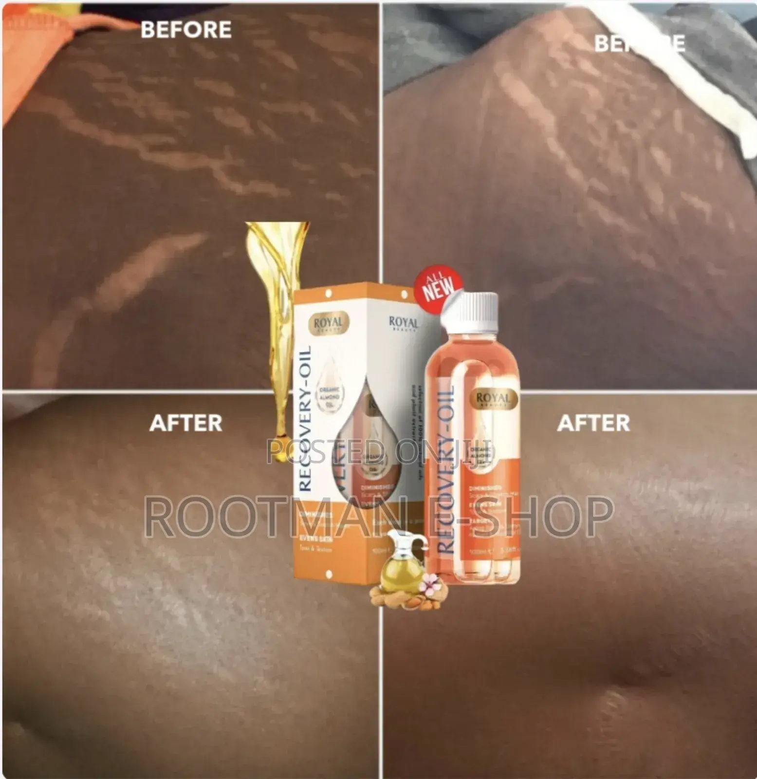 Scares Stretch Marks (Recovery Oil)
