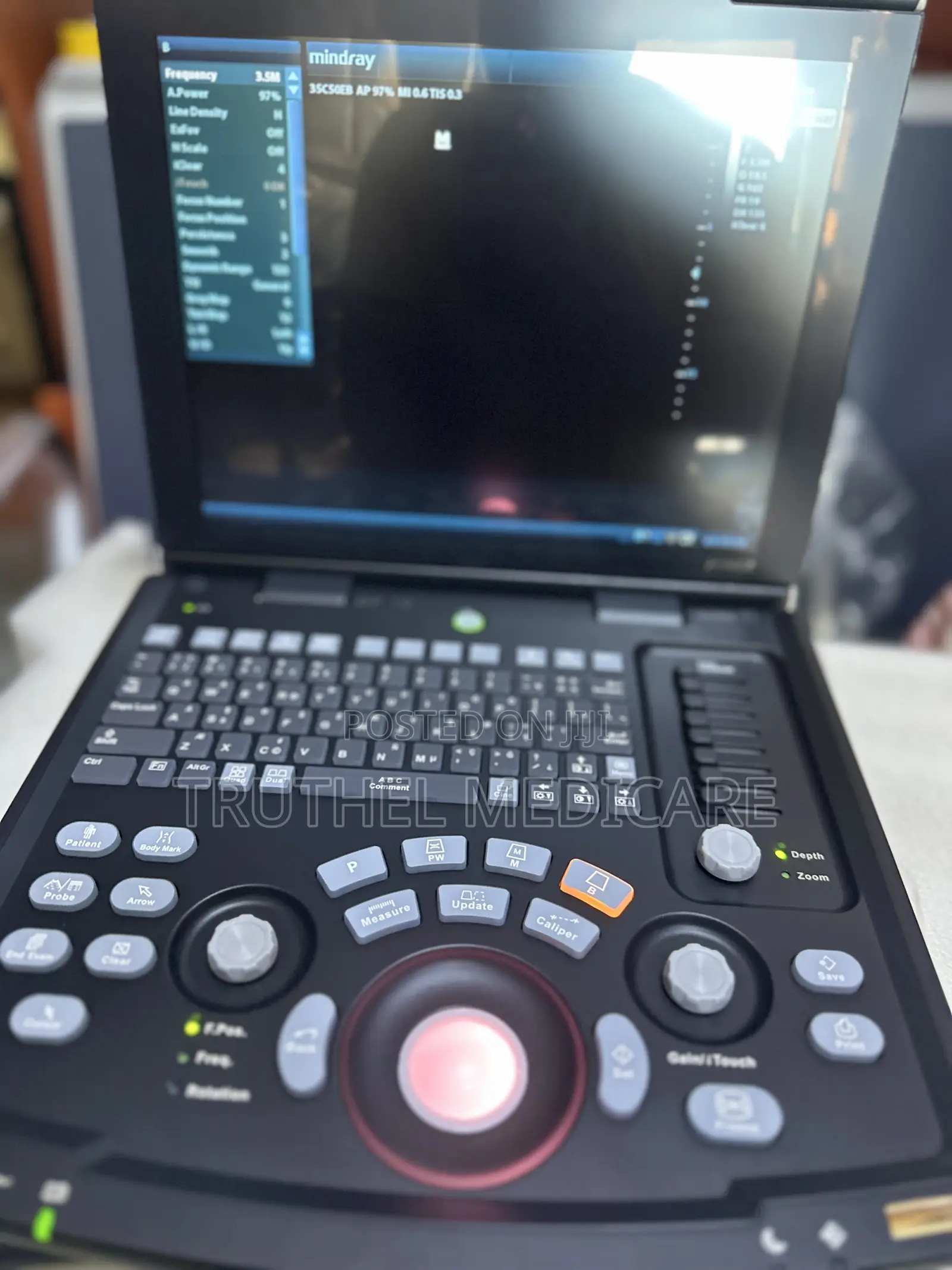 Mindray Portable Ultrasound Scan Machine Dp10(With Convex Probe