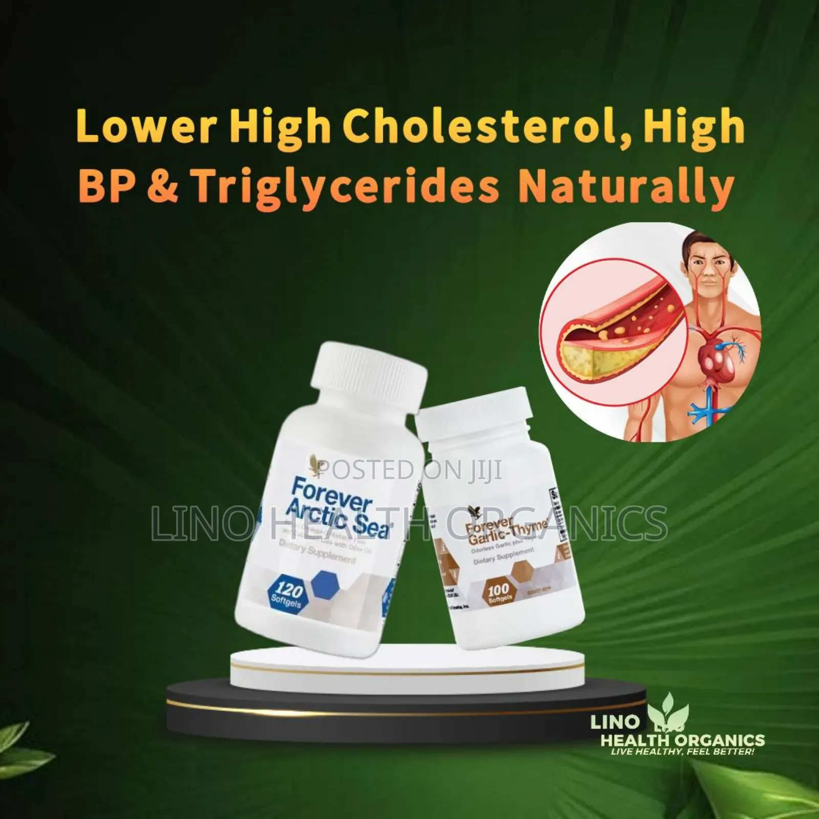 High Cholesterol Natural Support Remedy
