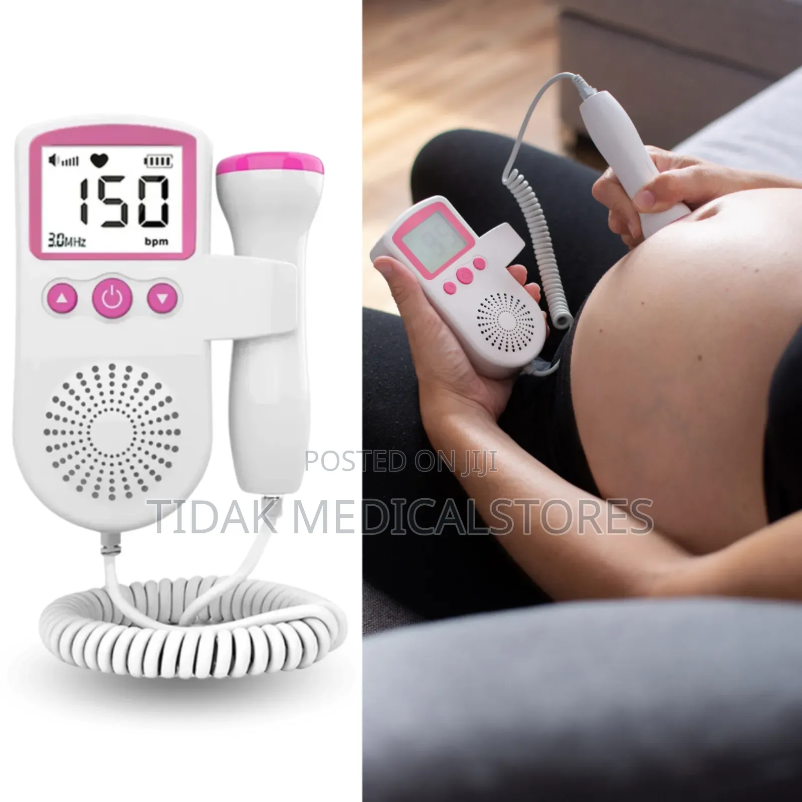 Fetal Doppler/Baby's Heart Rate Monitor