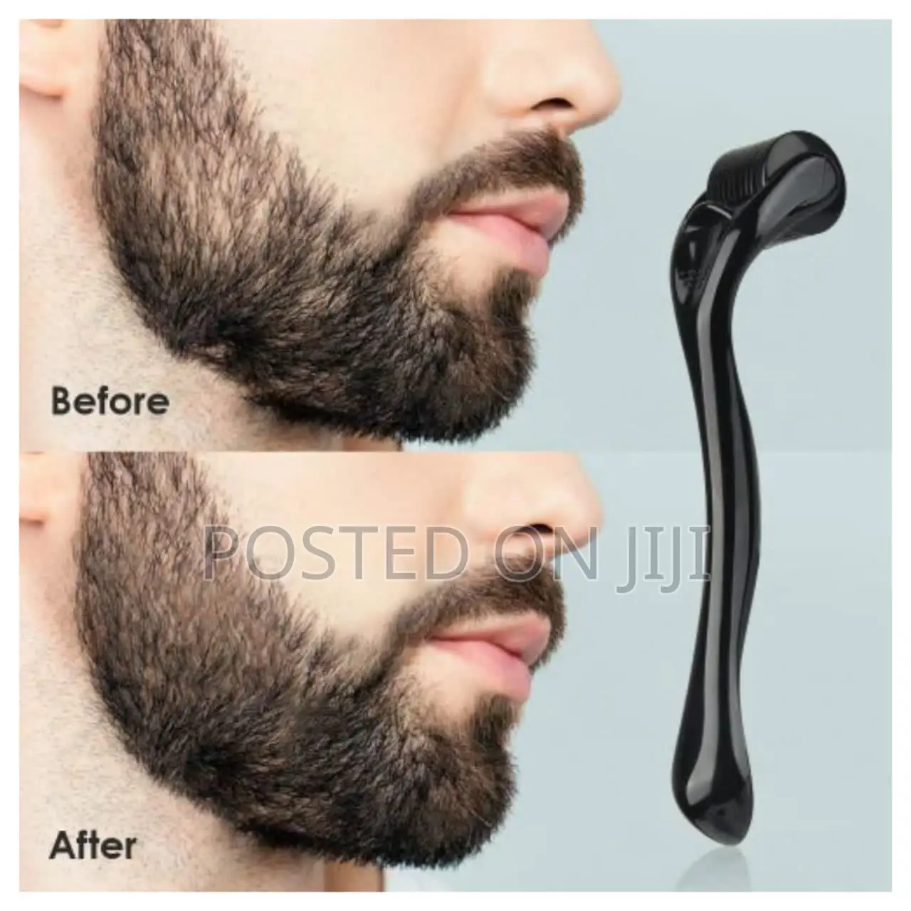 Derma Roller System 1.5,1.0,0.5