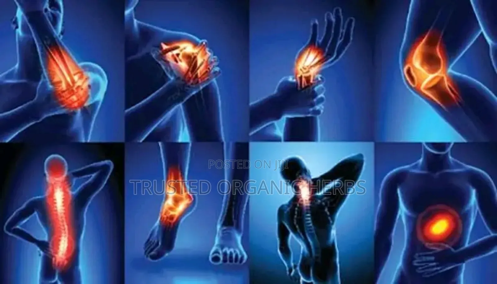 Joint Pains, Osteoarthritis, Rheumatoid Arthritis Natural Solution