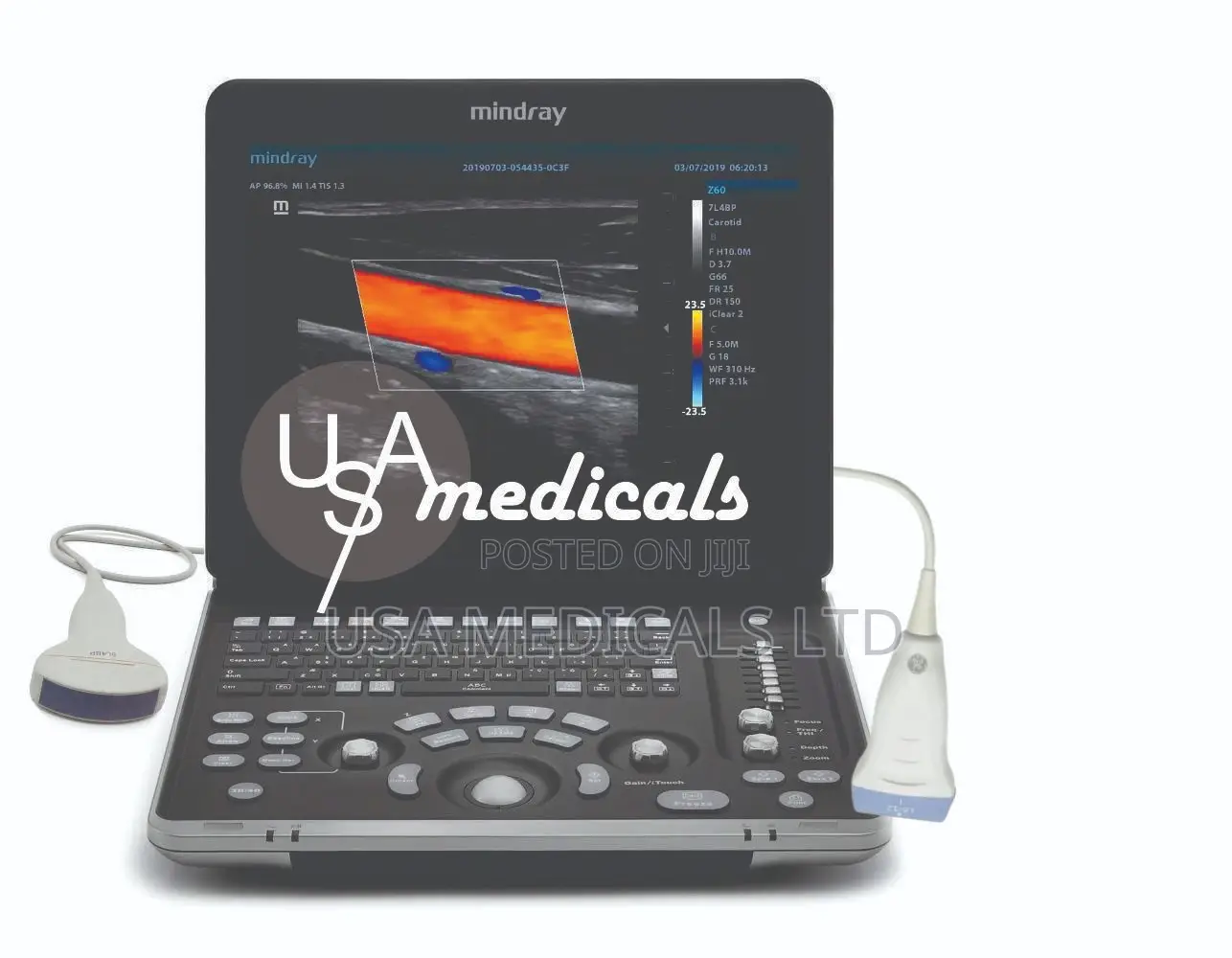 Mindray Z60 Ultrasound Scan Machine ( Linear + Convex Probes )