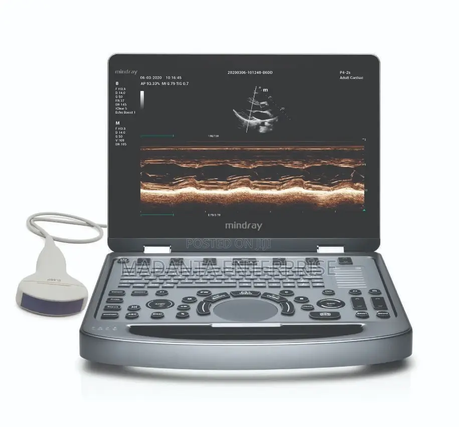 Mindray Dp10 Ultrasound Scan Machine