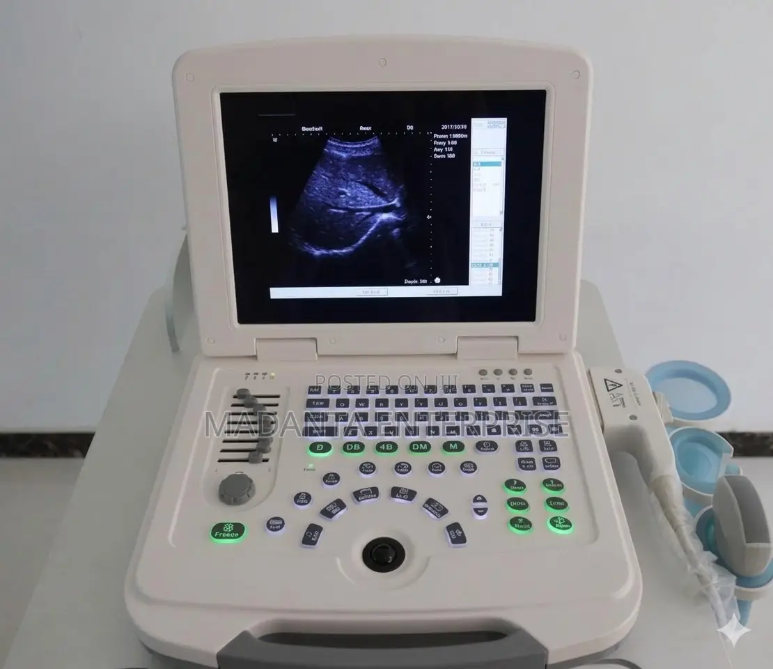 Ultrasound Scan Machine