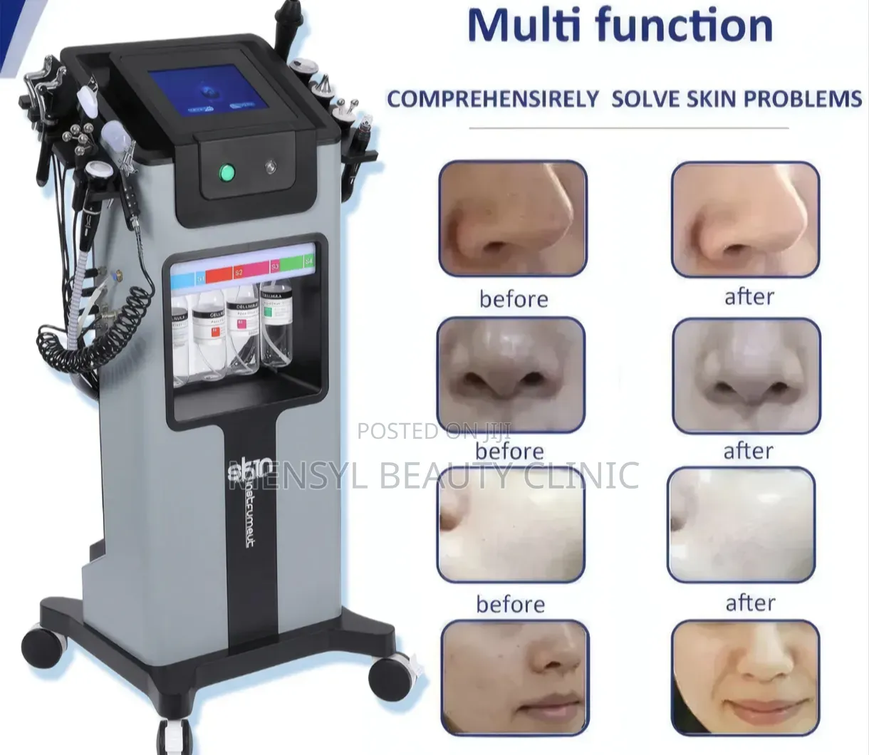 14 in 1 Hydro Facial Machine High Quality