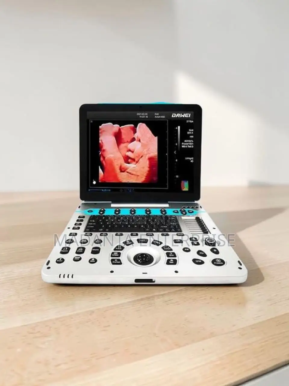 Ultrasound Scan Color Doppler "Dawei"