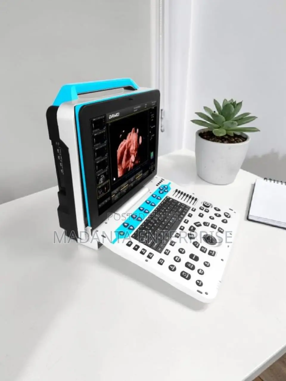 Ultrasound Scan Color Doppler "Dawei"