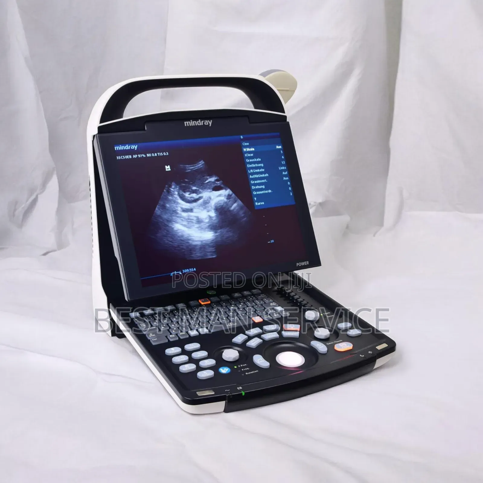 The Mindray Scan Machine
