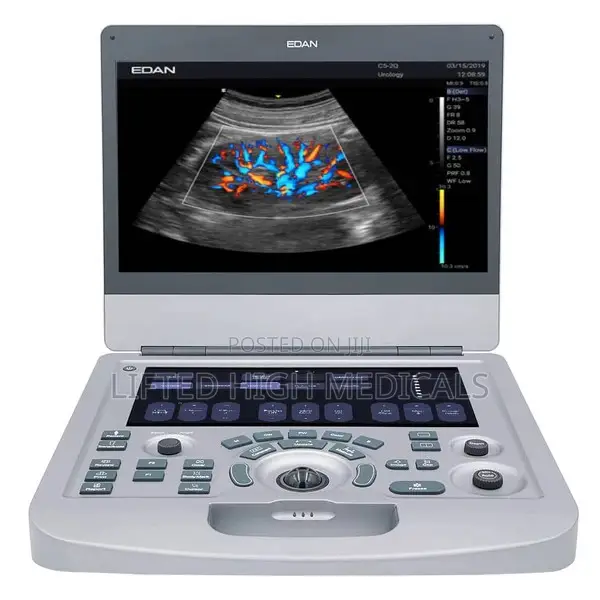 Edan Acclarix Ax3 Portable Color Doppler Ultrasound